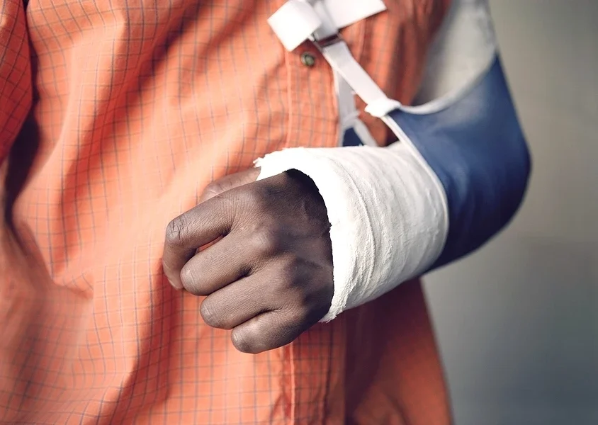 Close up of person with a hand cast